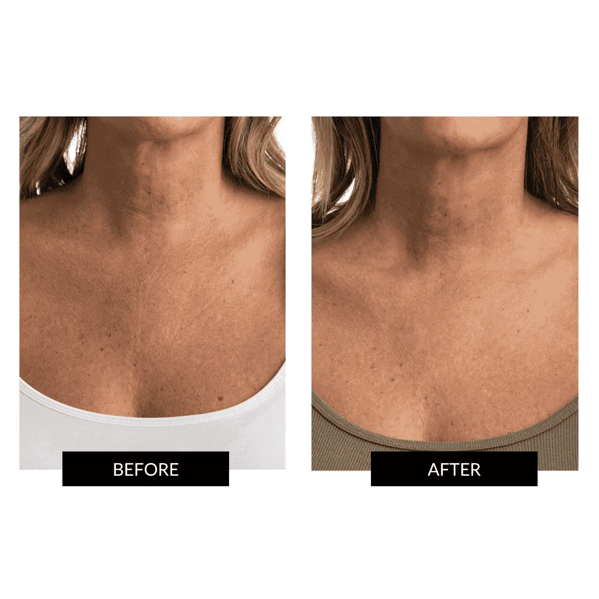 CurrentBody Skin LED Face & Neck Kit - Black Friday Offer