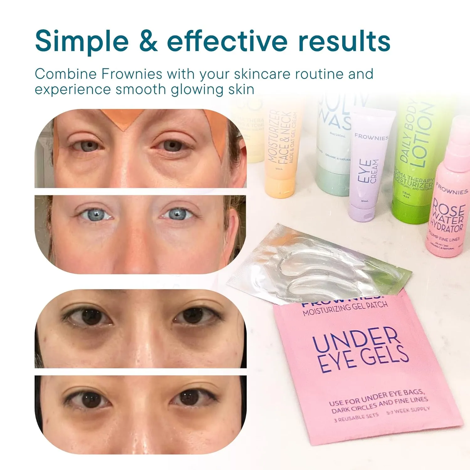 Frownies Under Eye Gel Patches for Puffy Eyes