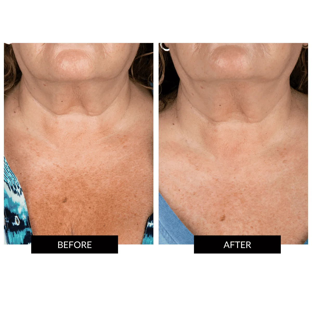 Offer - CurrentBody Skin LED Neck and Dec Rejuvenating Device