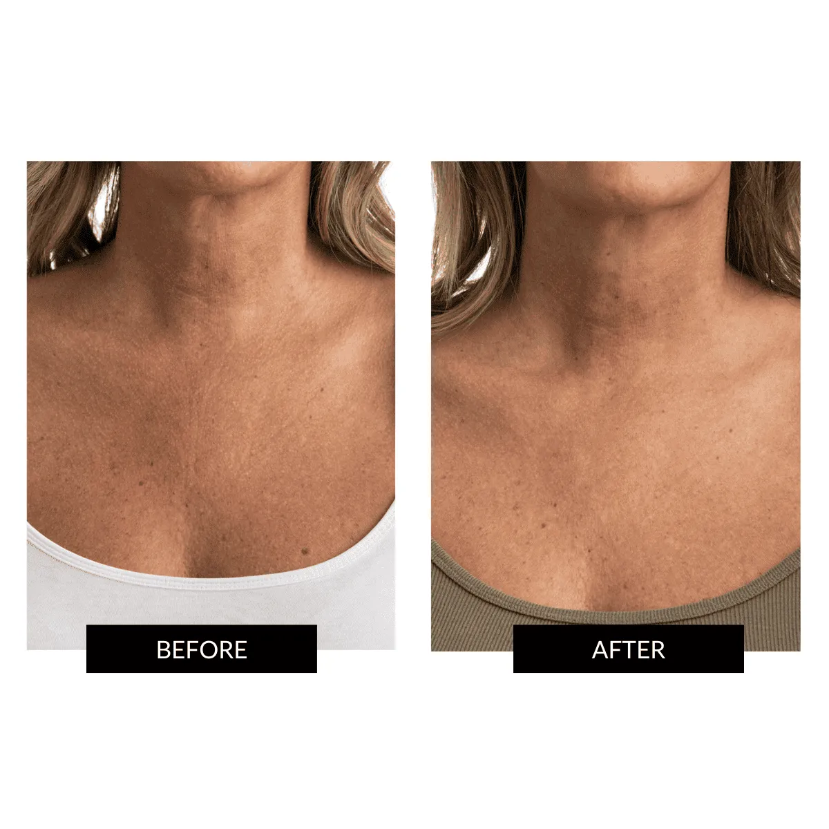 Offer - CurrentBody Skin LED Neck and Dec Rejuvenating Device