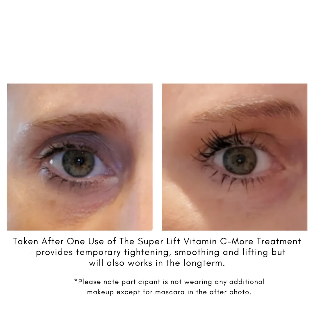 THE SUPER LIFT – Vitamin C-More Treatment